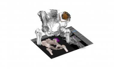 3d systems dicom to print 医疗三维建模软件